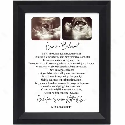 Canım Babacığım Ultrason Fotoğraflı Babalar Günü Çerçevesi