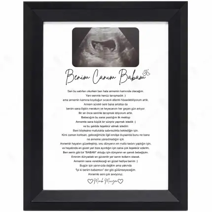 Benim Canım Babam Kişiye Özel Ultrason Fotoğraflı Anı Çerçevesi